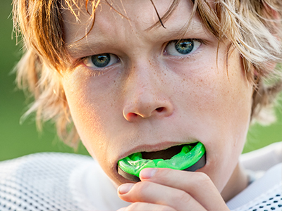 Sports Mouthguards